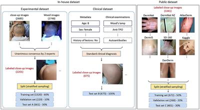 Design and Assessment of Convolutional Neural Network Based Methods for Vitiligo Diagnosis